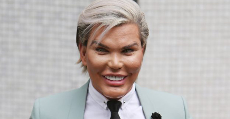 Brezilyalı Rodrigo Alves'in Son Hali Korku Yarattı!