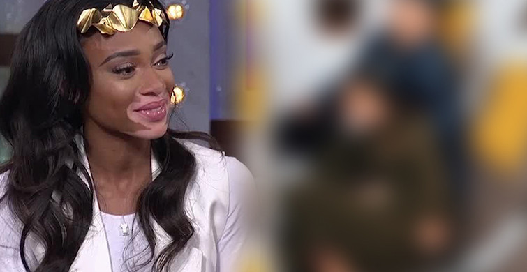 Winnie Harlow Uçak Pozu İle Olay Oldu