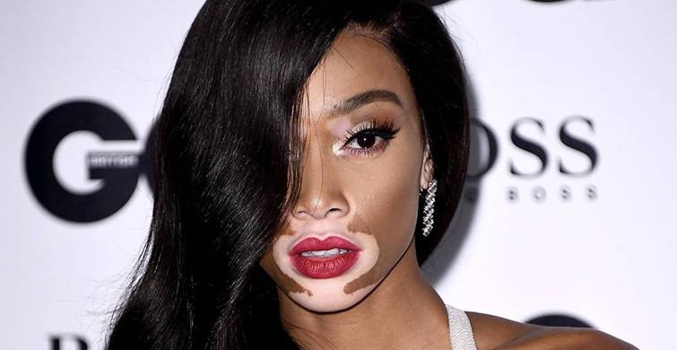 Geçtiğimiz Günlerde Victoria’s Secret Meleği Seçilen Winnie Harlow