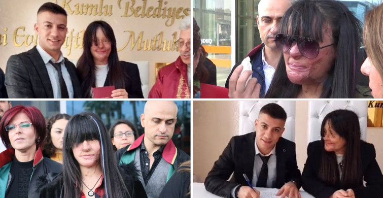 Yüzünü Yakan Kişiyle Evlenen Berfin Özek’in Babası Konuştu