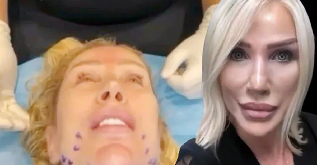 Gençleştirici işlemler yaptırdı