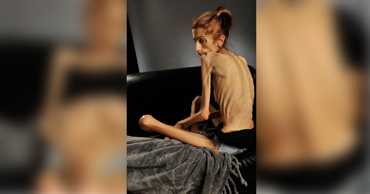 Kalıcı sağlık sorunları oluştu