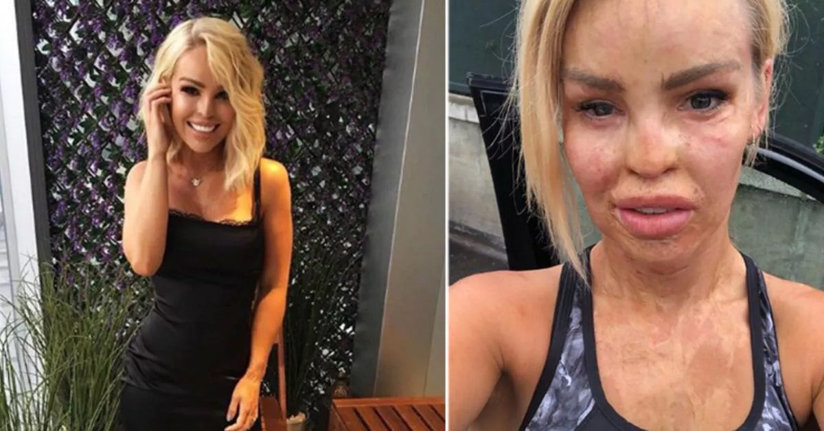 Kendisiyle barıştı