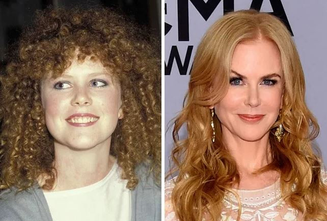 Nicole Kidman