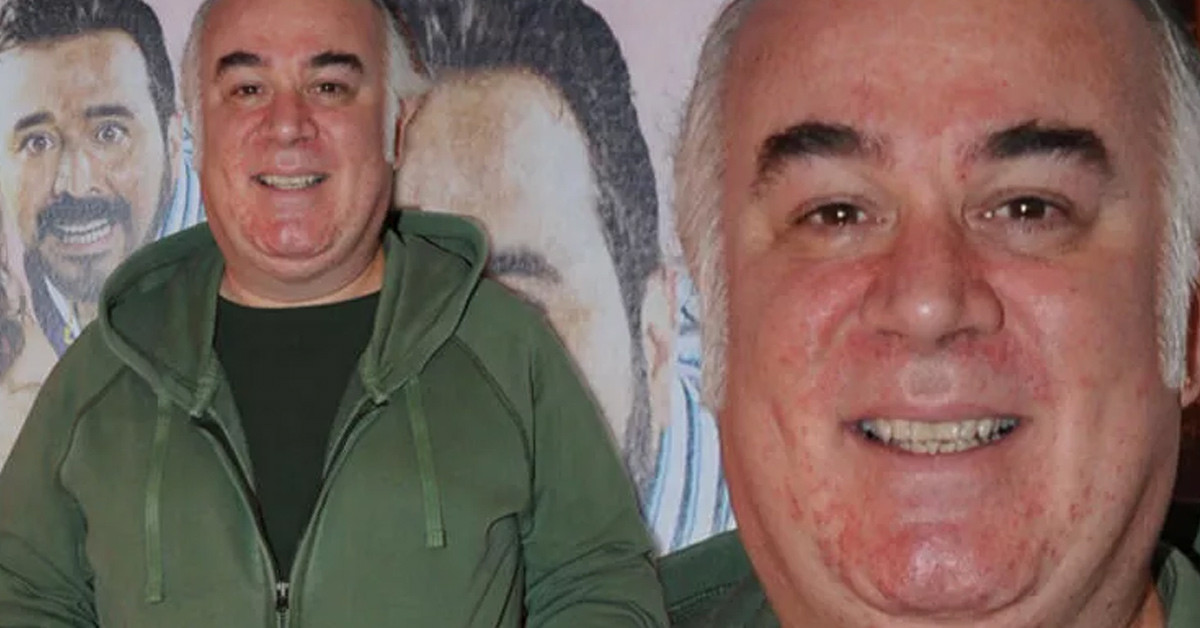 Kameralara saldırdı