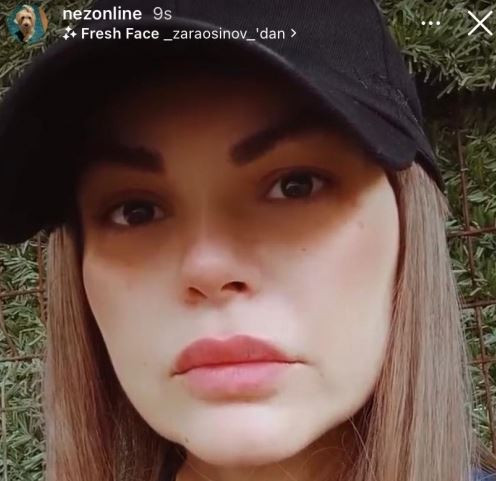 Ünlü Şarkıcı Nez'in Estetikleri Şaşırttı