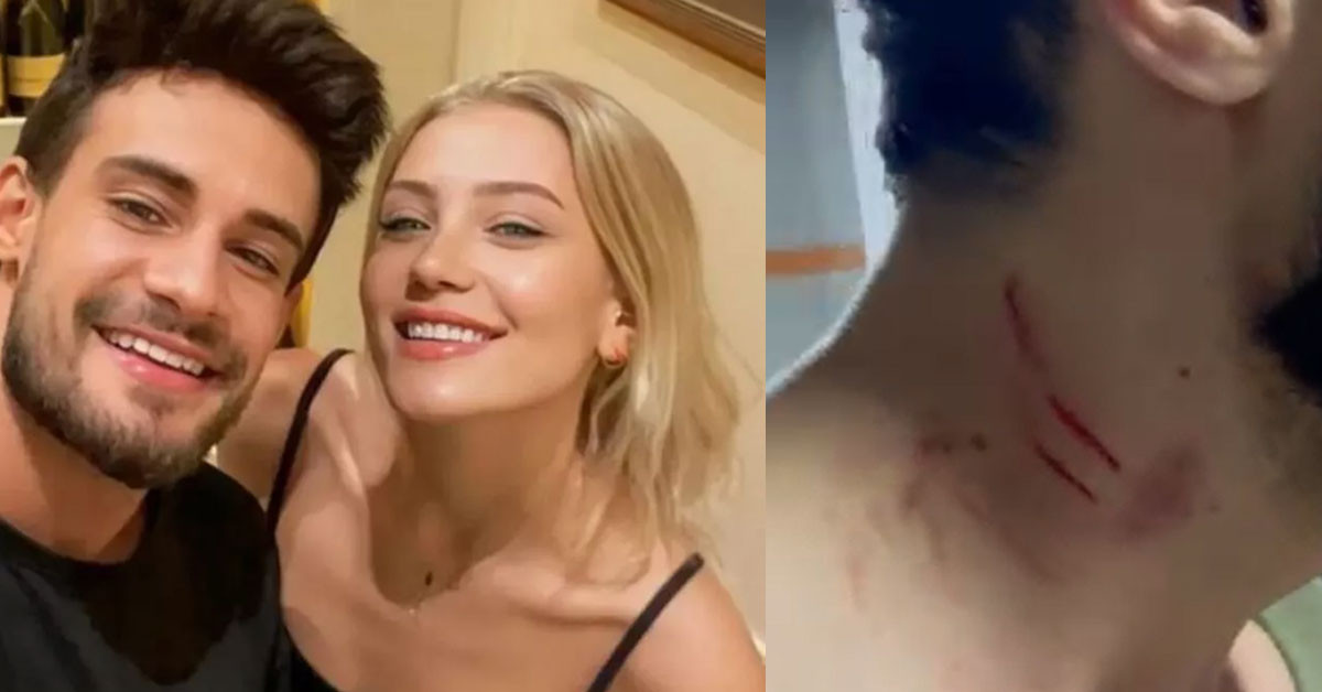 Şiddet iddiası hakkında Batuhan Karacakaya'dan açıklama 