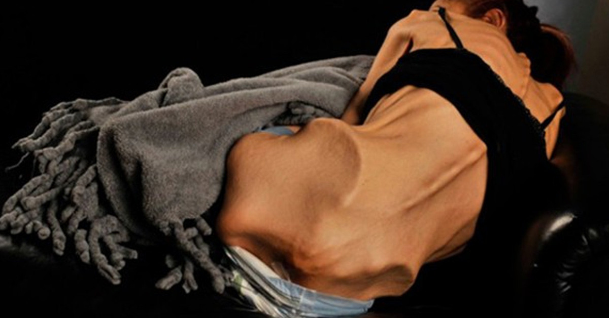 10 YIL ÖNCE SAĞLIKLI BİR KADINDI