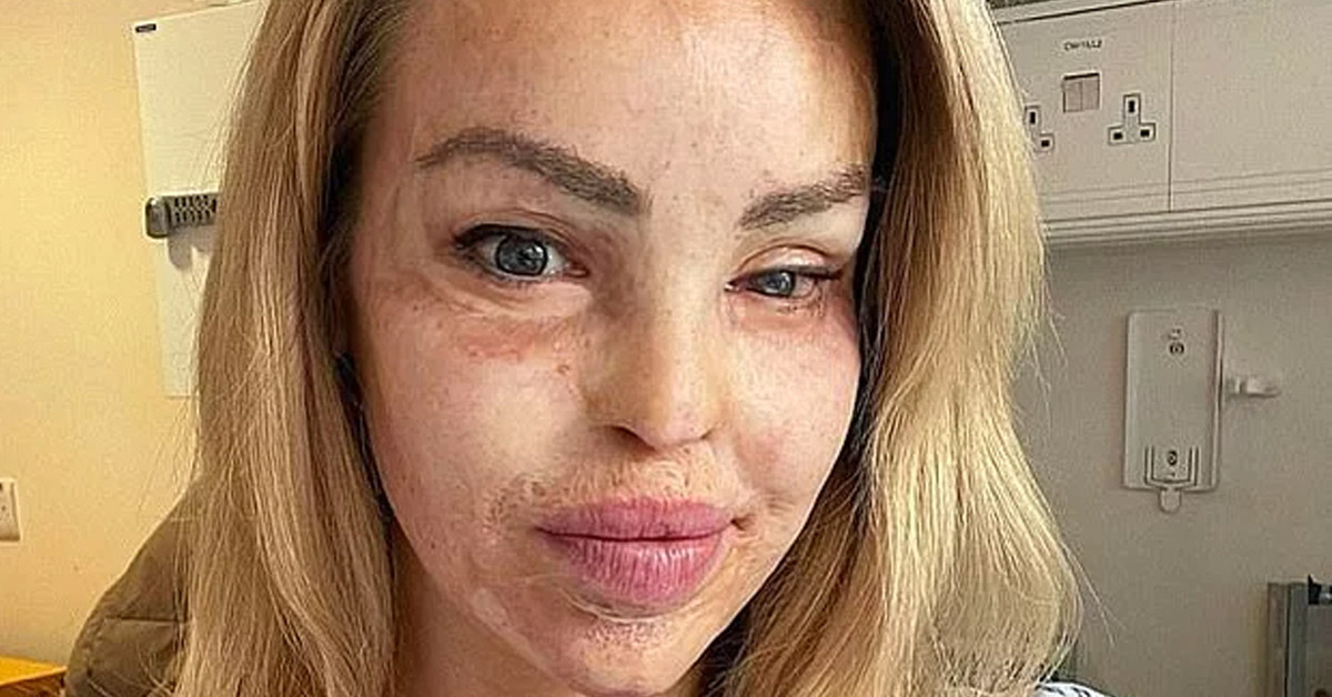 Bergen'i hatırlattı