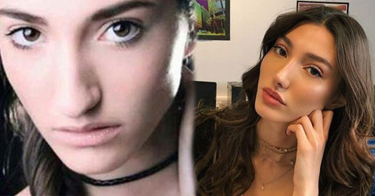 Estetik yaptıran ünlüler