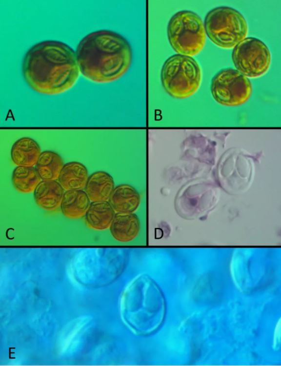 "OMÜ ADINA BİZİ GURURLANDIRAN BİR BAŞARI"