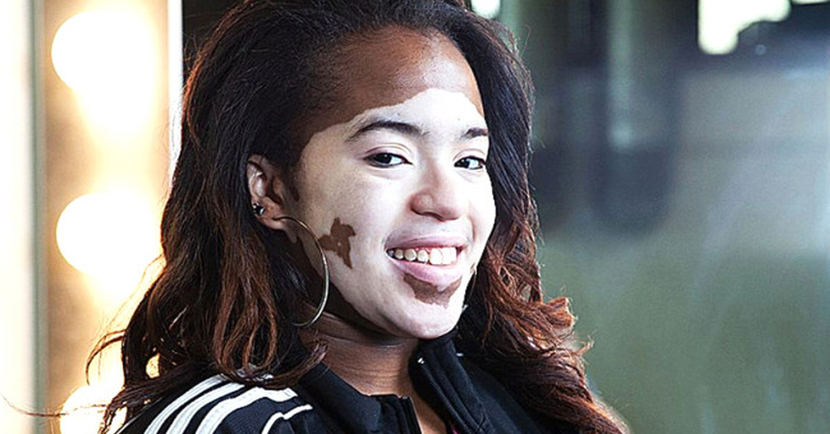 11 YAŞINDAYKEN FARK ETTİ