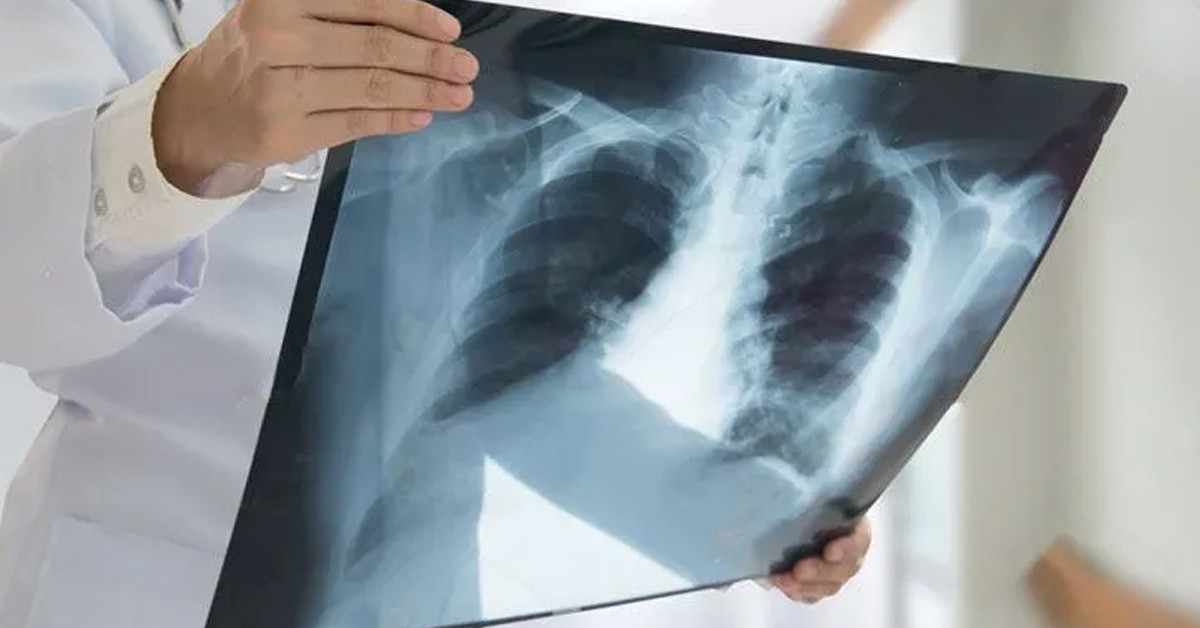 Psikolojik sorunları var