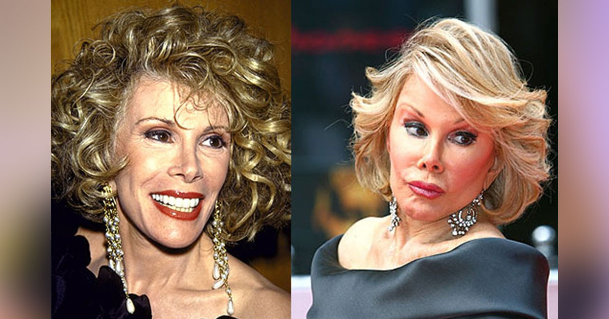 Joan Rivers