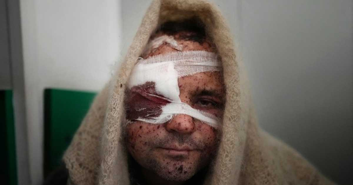 Rusya bir aydır Kiev'e giremedi