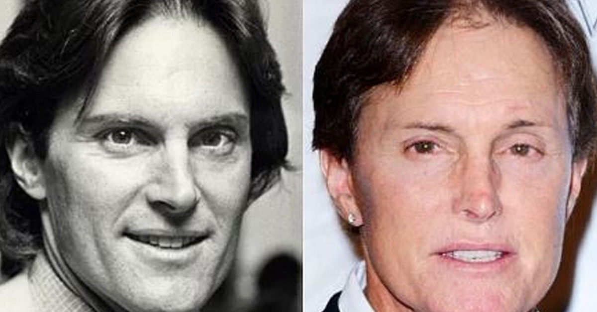Bruce Jenner