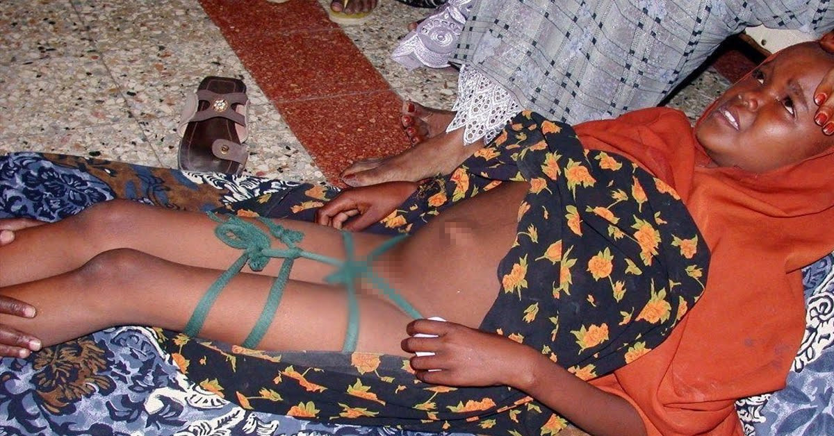 125 milyon kadın sünnet oldu