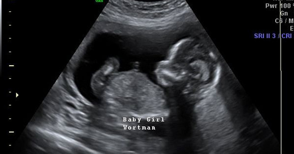 Doktorlar inanamadı