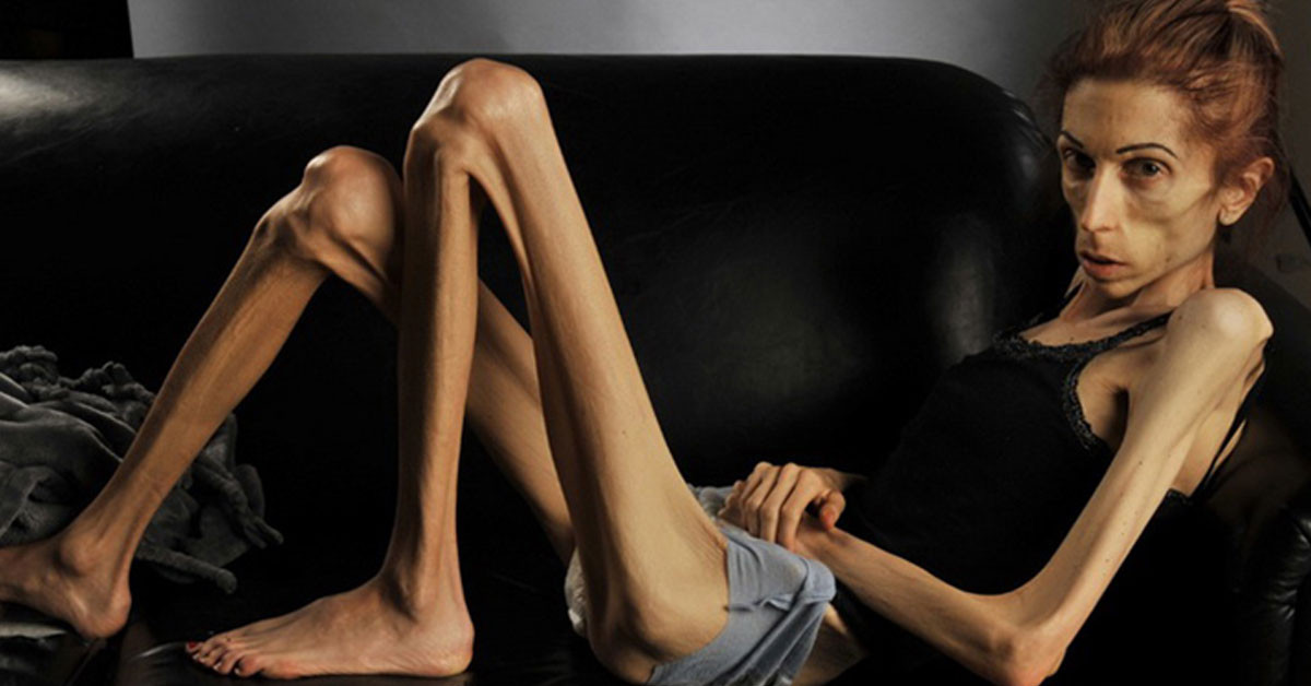 Bir deri bir kemik kaldı