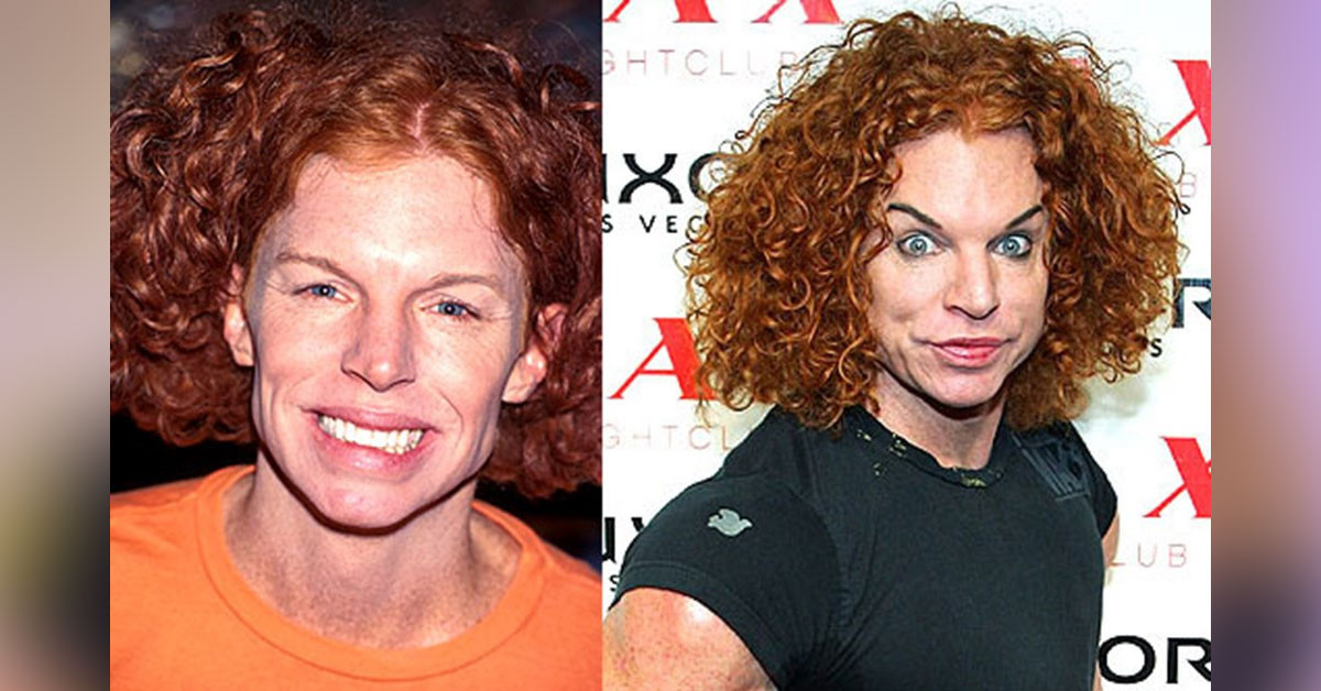 Carrot Top