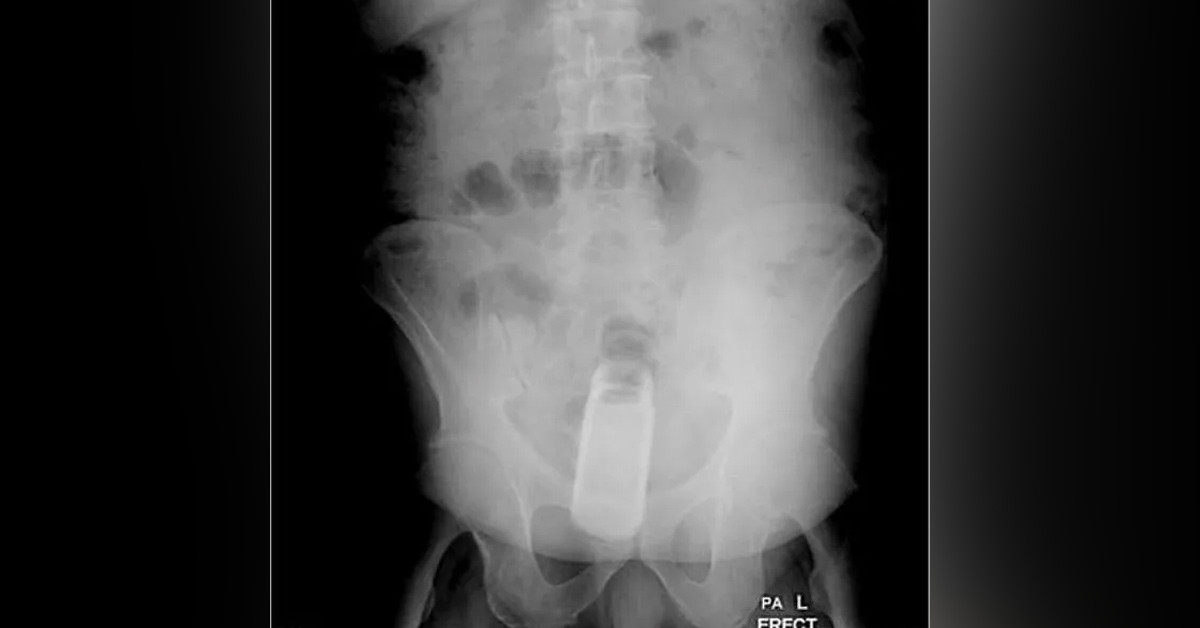 Karısı anlam veremedi