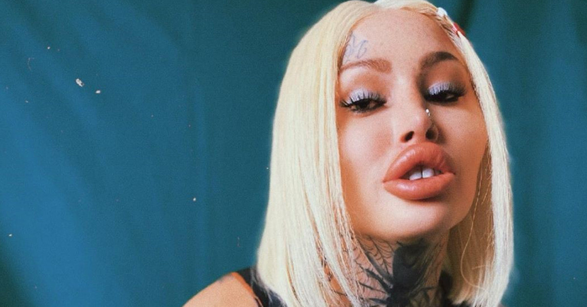 Estetik ameliyatı geçirdi