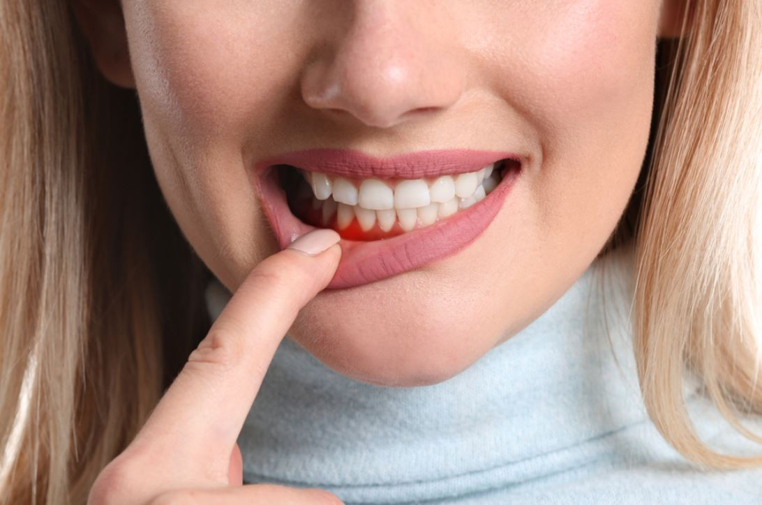 DİŞ ETİ SORUNLARINIZI GEÇİŞTİRMEYİN!