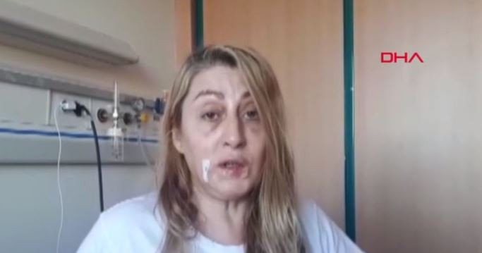  DUDAĞI ÇÜRÜDÜ ŞİKAYETÇİ OLDU