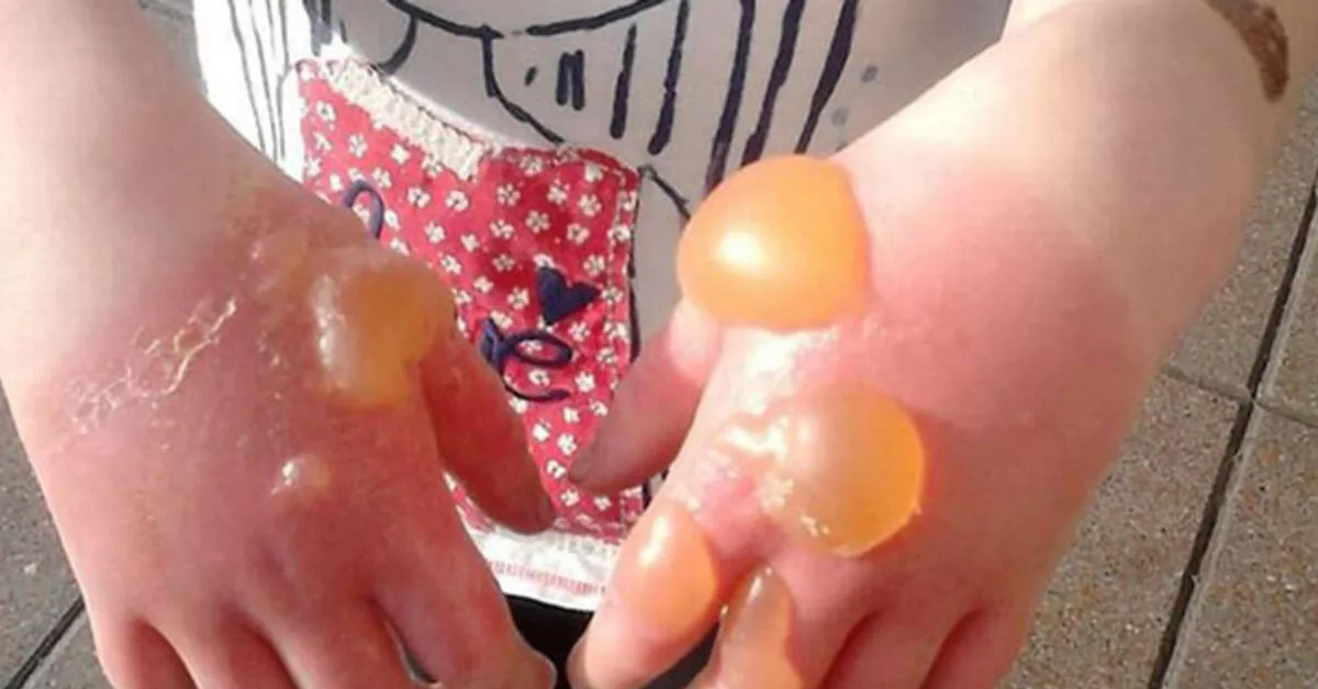 Zehirli Tavşancıl Otu