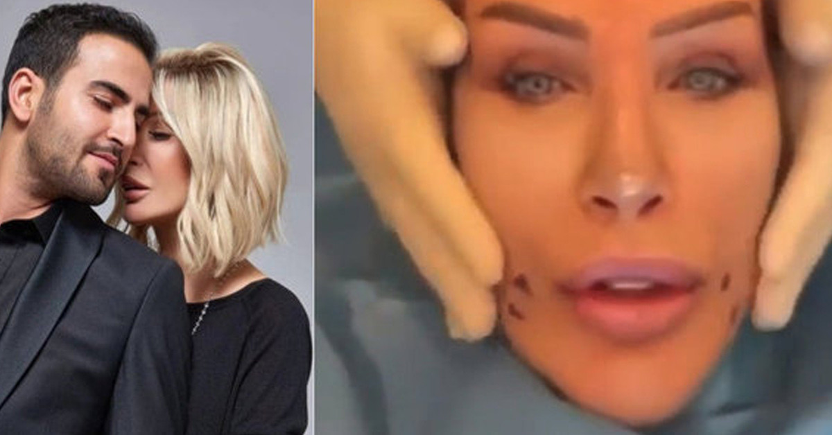 Tekrar estetik ameliyatı oldu