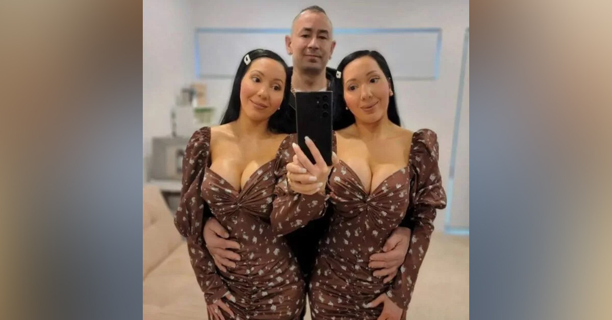 Tek yumurta ikizleri