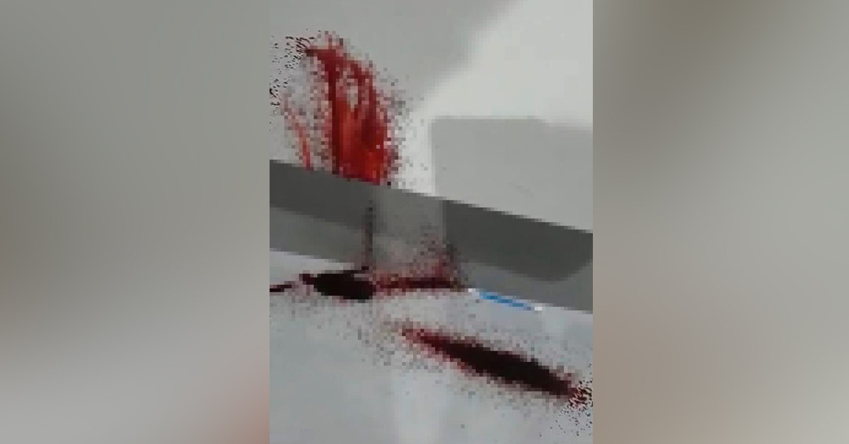 Duvarlardan kan fışkırıyor