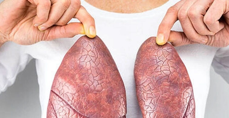 Akciğer Sertleşmesi