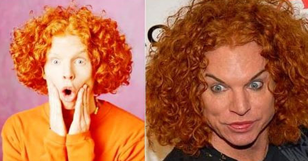 Carrot Top