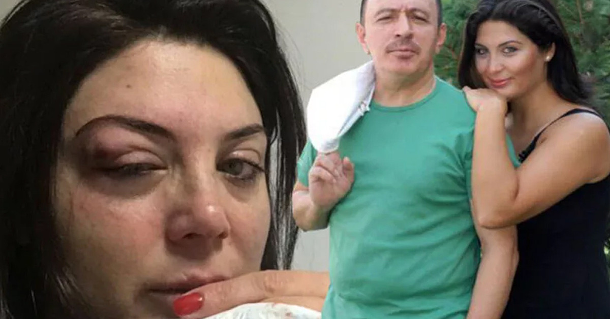 Eşi hastaneye kaldırıldı