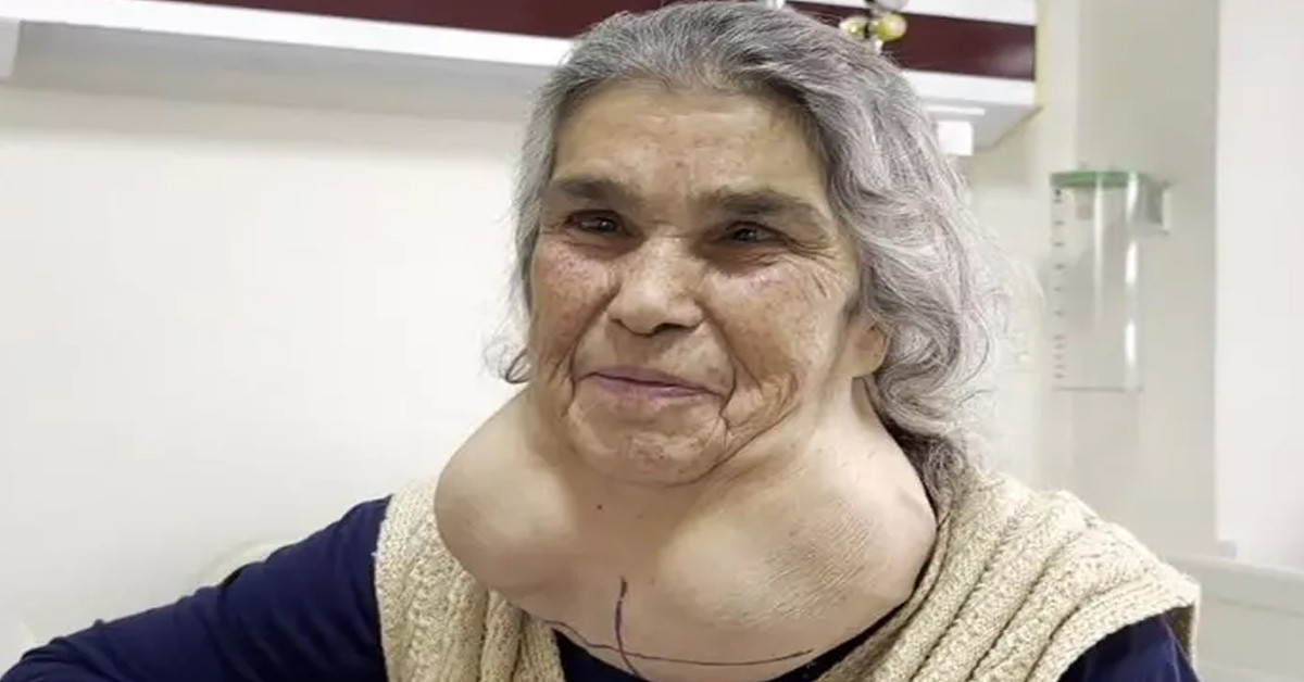 Bu belirtileri yaşıyorsanız dikkat!