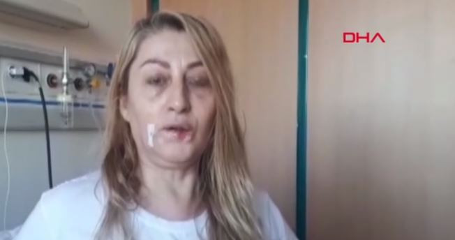 OPERASYON BAŞARISIZ OLDU