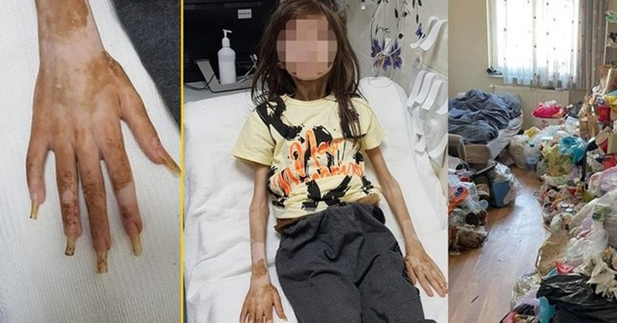 Sağlık durumu açıklandı