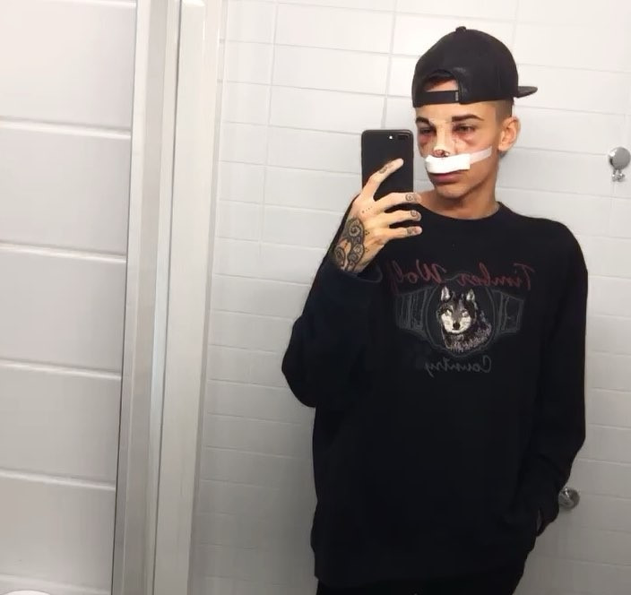 İLK ESTETİĞİNİ 19 YAŞINDA YAPTIRDI!