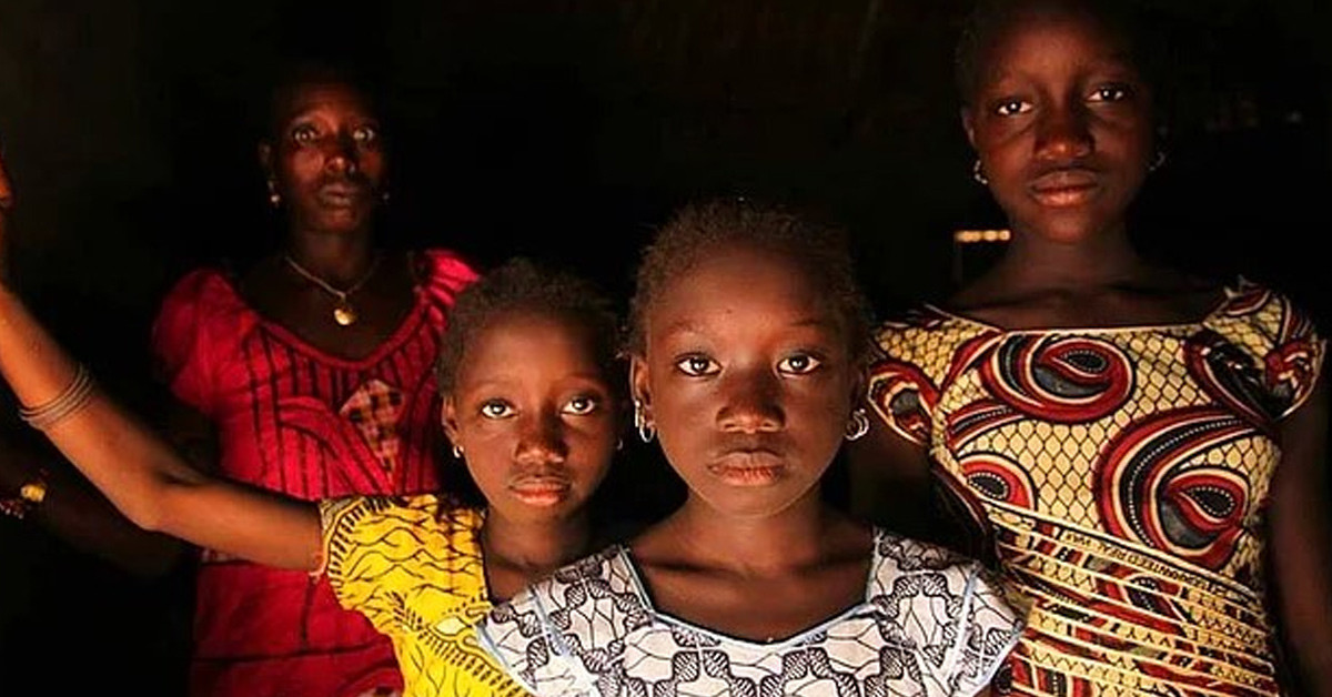 Bir kısmı da sünnet edilecek