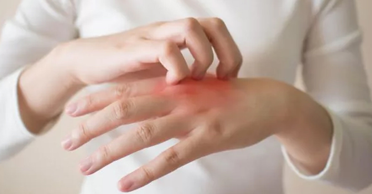 Tedavinin ortaya sebebi