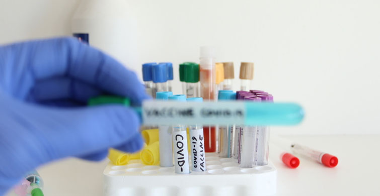 SICAKLAR VİRÜSÜ ORTADAN KALDIRACAK MI ?