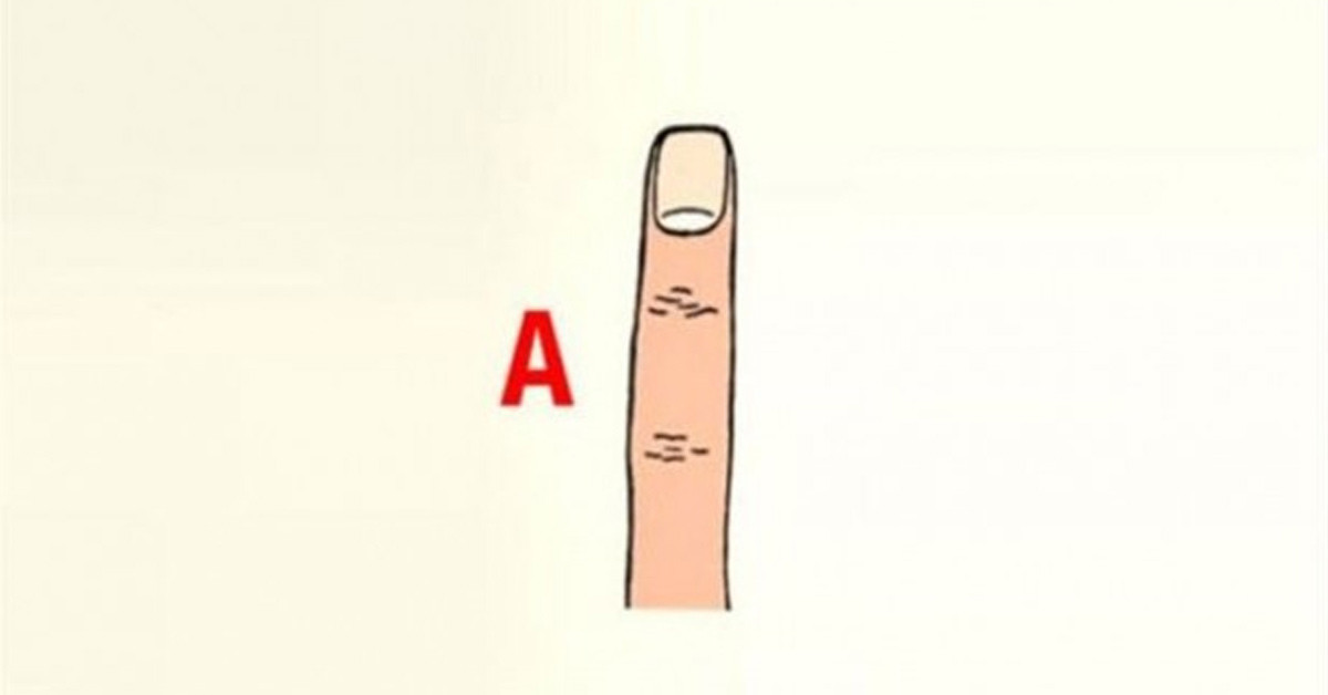 A TİPİ PARMAK ŞEKLİ