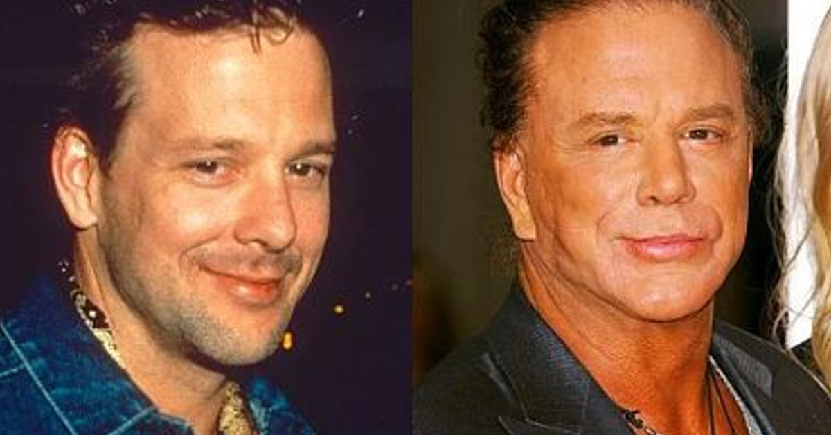Mickey Rourke