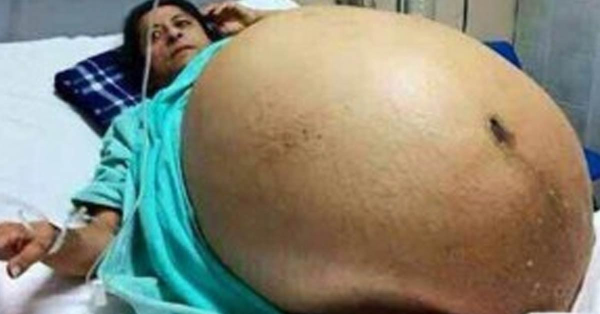 11 çocuk doğurmuş gibi