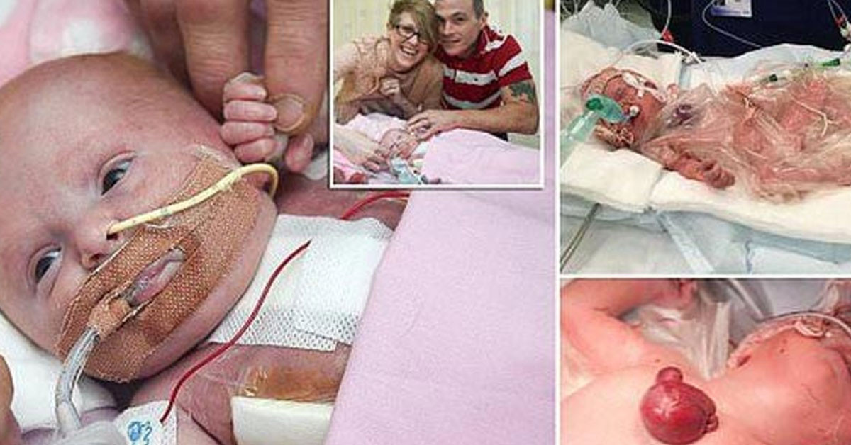 Hayatta kalması imkansız dediler