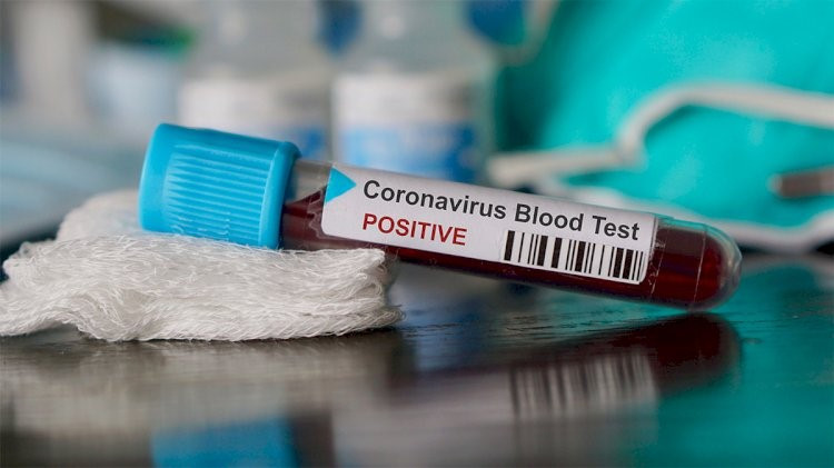 'Sokaktan Geçen Herkesi Kapsamıyor'