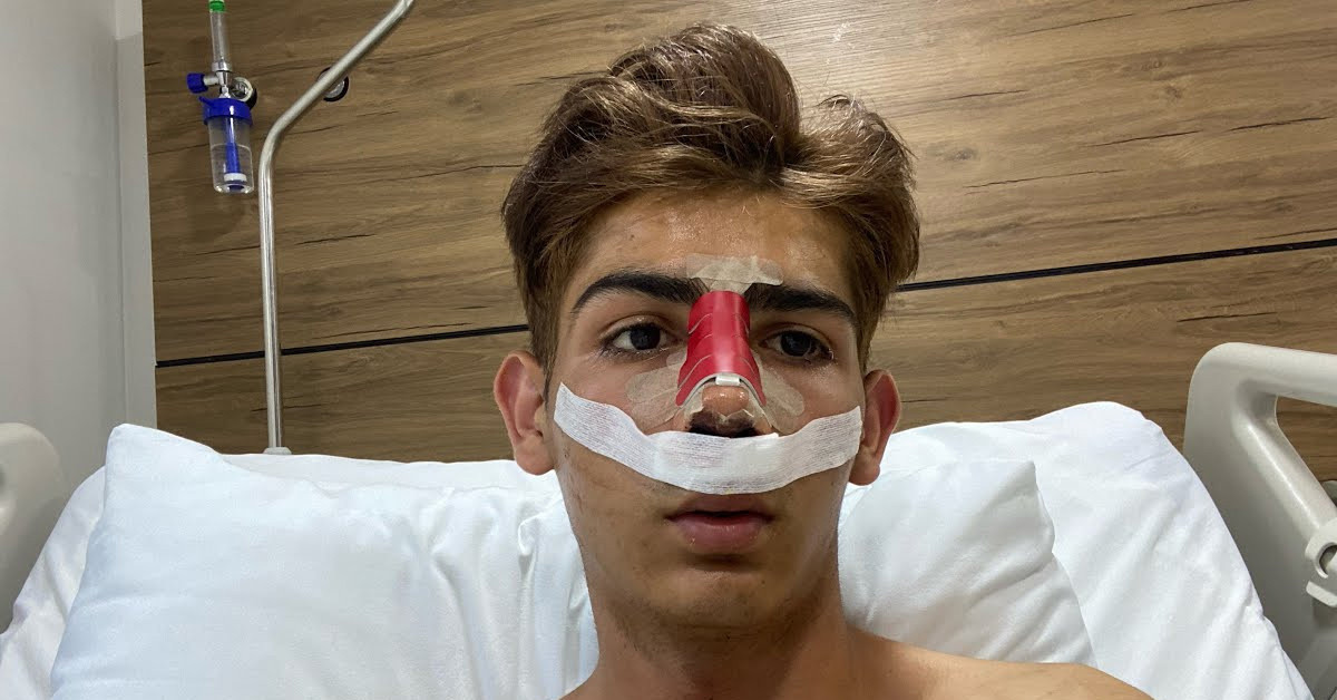 Estetik operasyonları geçirdi