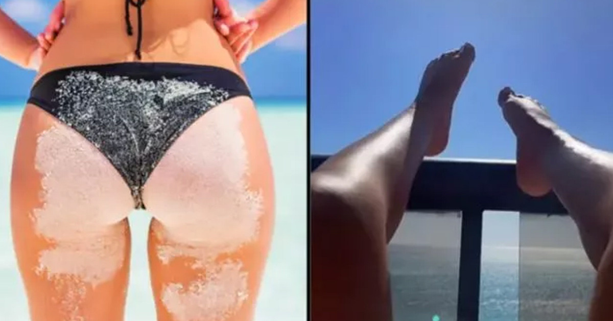 Perine güneşlenmesi