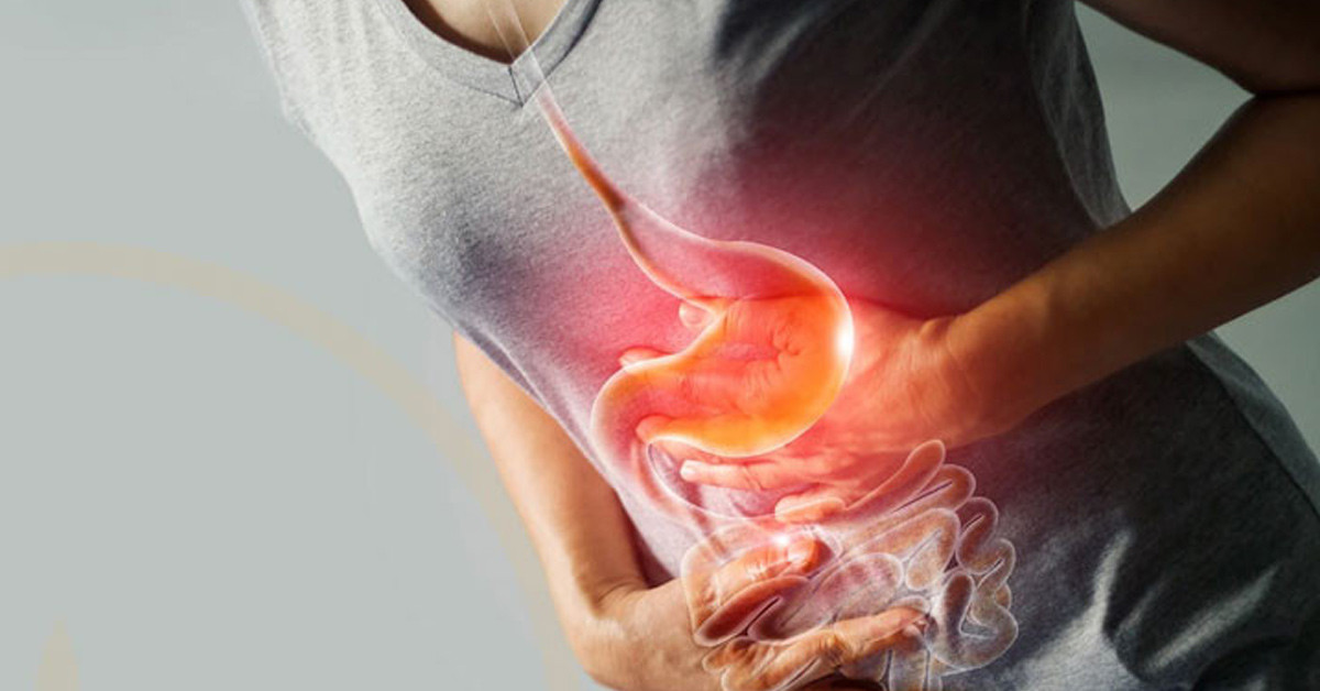 Bağırsak Kanaması